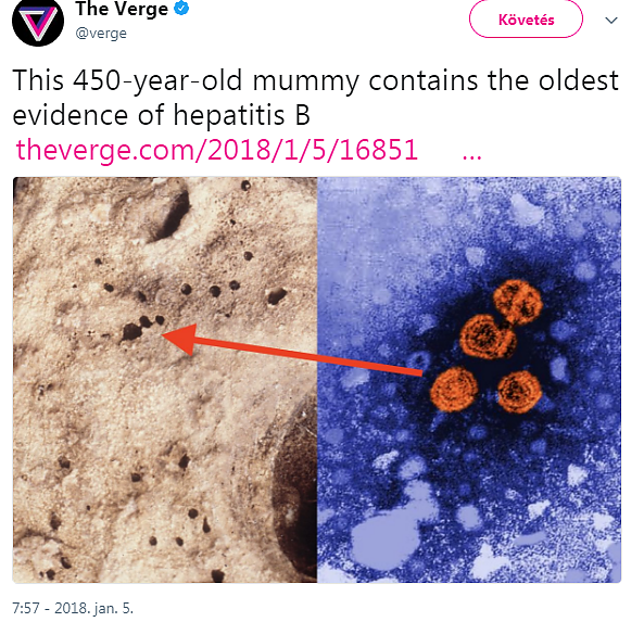 hepatits_b.png