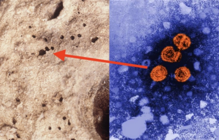 Megtalálták a Hepatitis-B legkorábbi bizonyítékát egy 450 éves múmiában